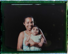 In this Sept. 29, 2016 photo made from a negative recovered from instant film, Tatiane do Nascimento holds her son Willamis Silva, who was born with microcephaly, one of many serious medical problems that can be caused by congenital Zika syndrome, as they pose for a photo in Recife, Pernambuco state, Brazil. Willamis was having swallowing problems and not gaining weight so a feeding tube was introduced, which in less than a month he pulled out a couple of times. Barbosa, who has two other children, says she used to take Williamis daily to the hospital or physical therapy, but now they are going two or three times a week. AP Photo/Felipe Dana