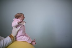 Feb. 12, 2016 file photo shows two-week-old Sophia, diagnosed with microcephaly, during a physical therapy session at the Pedro I hospital in Campina Grande, Brazil. The World Health Organization declared the Zika virus and its suspected link to birth defects an international public health emergency. 