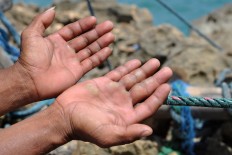 A cable car operator shows his calloused hands. Every Sunday, 12 cable car operators can each earn up to Rp 400,000 (US$30). JP/Magnus Hendratmo