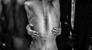 Family shares small home with mentally ill