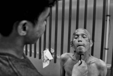 A patient shows his colleagues how to get rid of hallucinations by covering his ears. Antara/Hafidz Mubarak