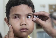 Good fit: Rizwan matches an artificial eye to Besta's original one. JP/ Ben Latuihamallo 