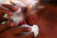 Blood flows from the back of one of his patients during therapy. JP/Boy T. Harjanto