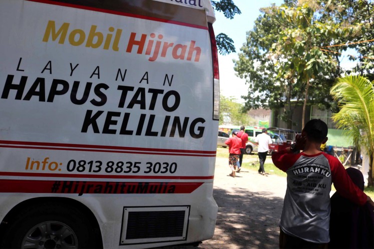 Achieving hijrah perfection by removing tattoos