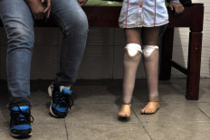 A prosthetic user has to practice walking to be able to adjust well. JP/ Magnus Hendratmo