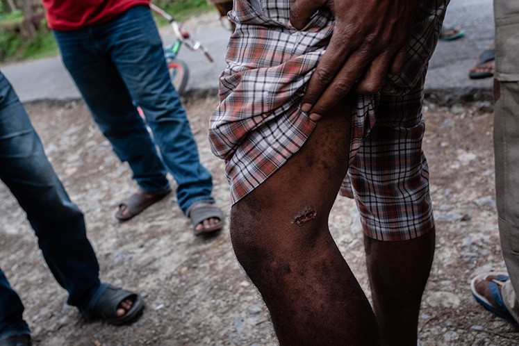 Wamena investigation: What the government is not telling us