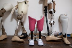Safitri’s new pink prosthetic legs after Putu Oktaviani, a staff member of Puspadi Bali, makes some finishing touches. According to Safitri’s mother Sofiani, her daughter chose pink because she loves the color.  JP/Agung Parameswara