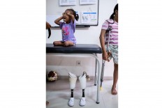 Safitri smiles after practicing to walk with her prosthetic legs. JP/Agung Parameswara