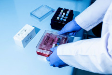 A laboratory worker prepares a box of reagents in the biomolecule laboratory of Warmadewa University in Denpasar, Bali. Reagents are chemical substances that can help detect SARS-CoV-2, the virus that causes COVID-19, in PCR samples. JP/Agung Parameswara